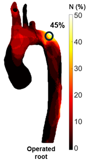 Figure 3. Quantification of aortic discplacement over the heartbeat