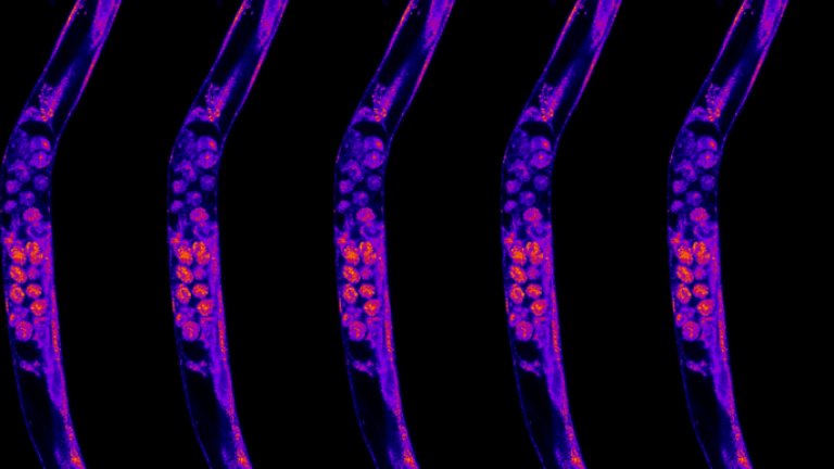 Houtkooper en zijn team slaagden erin om het leven van de worm C. elegans aanzienlijk te verlengen door de cellen van de worm in de spaarstand te zetten. Foto: Yasmine Liu, Amsterdam UMC