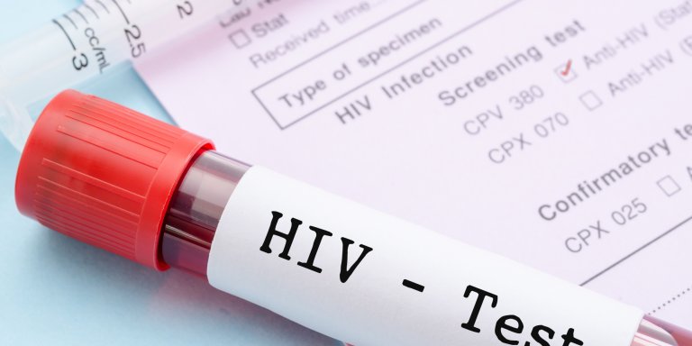 Nieuwe variant van hiv ontdekt die sneller ziek maakt