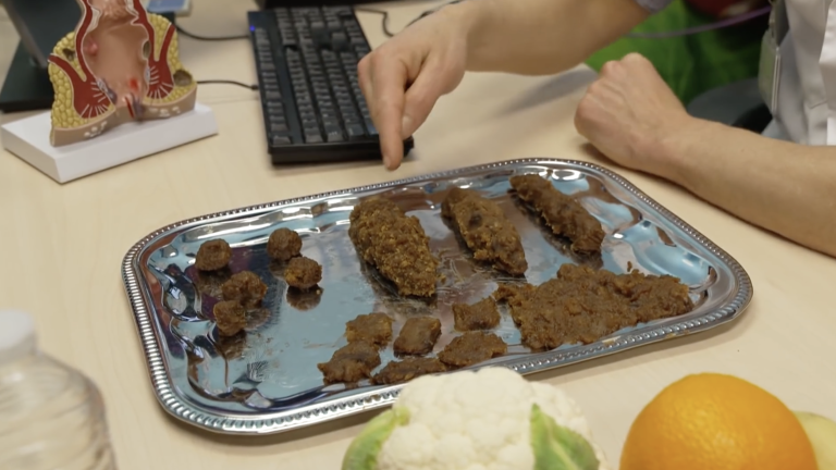 Het kinderprogramma Het Klokhuis maakte een aantal jaar terug een reportage over de poeppoli van Amsterdam UMC. Hier geeft de kinderarts uitleg over de verschillende typen poep die je kunt hebben. (foto: still uit Het Klokhuis)