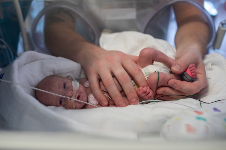 Veel te vroeg geboren baby's komen op de afdeling Neonatologie