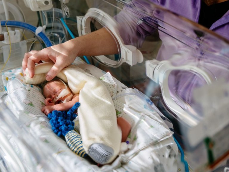 Many parents of very premature babies experience severe stress symptoms