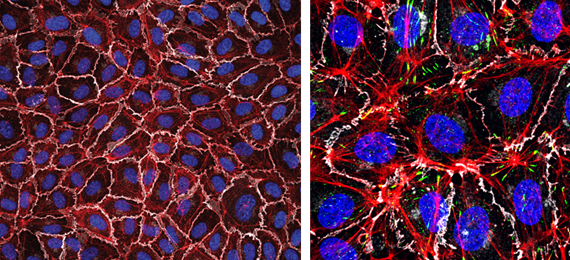 Left: Monolayer of human endothelial cells (White, VE-cadherin; red, F-actin; blue, nuclei). Right: zoomed image detailing F-actin in red, VE-cadherin in white and focal adhesions in green. Nuclei in blue.