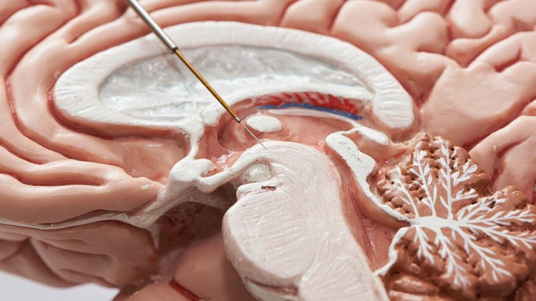   Deep brain stimulation is not used enough in psychiatric patients  
