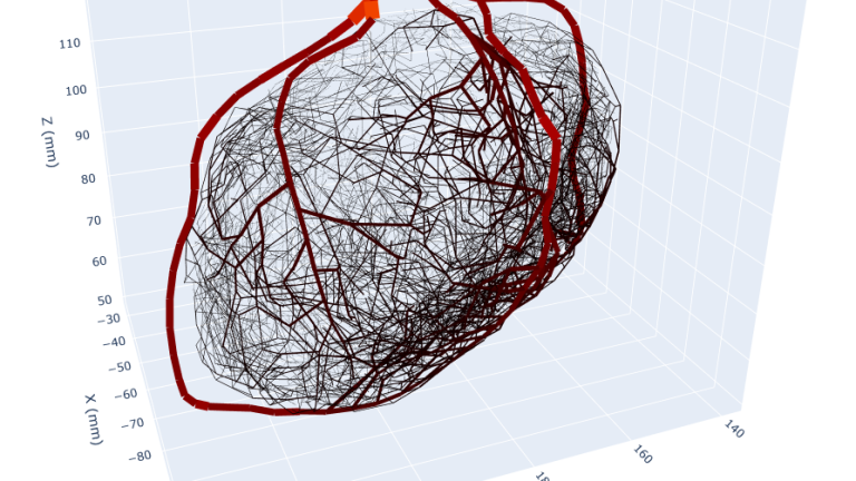 Patient-specific epicardial left coronary arteries, which are synthetically extended. 