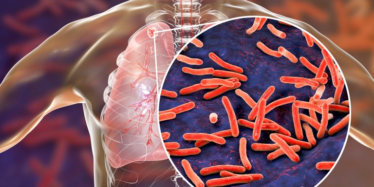 Aanknopingspunt voor nieuwe behandeling tuberculose ontdekt 