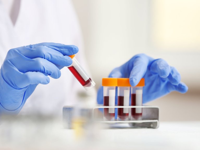 Betrouwbare test beschikbaar om kinderen met Foetaal Alcohol Syndroom te herkennen