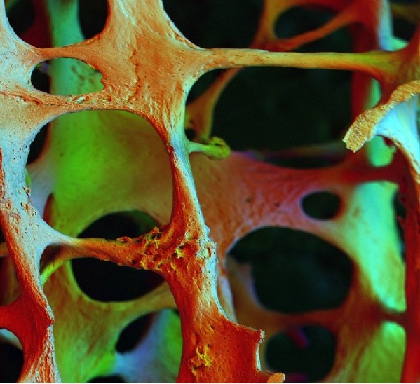 Grant of 30.000 euro from VU-UT Twente for Broken Bone Repair Model