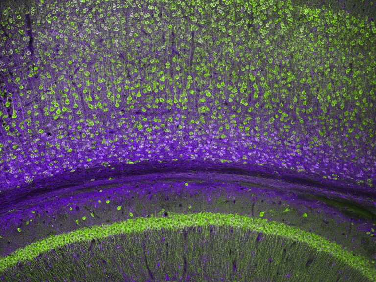 Researchers identify protein signatures in memory-encoding synapses