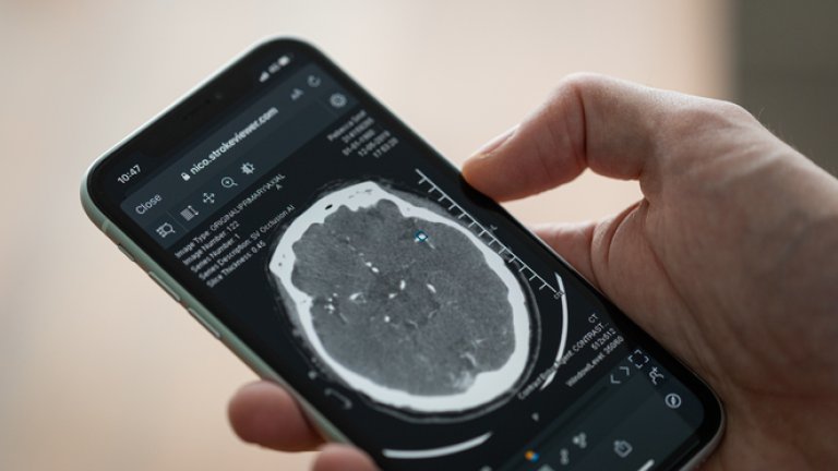 Via StrokeViewer krijgt de radioloog de hersenscans in een mum van tijd doorgestuurd naar zijn telefoon.