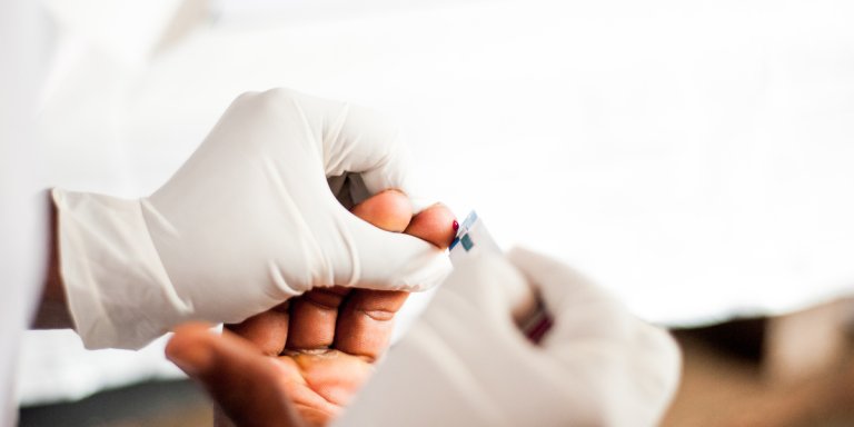 Kansen vroege opsporing hiv onnodig gemist