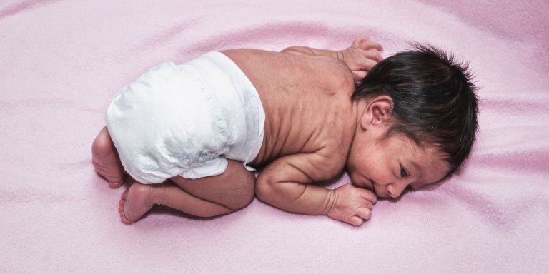 Hoe babyplasjes de kwaliteit van donornieren kunnen verbeteren