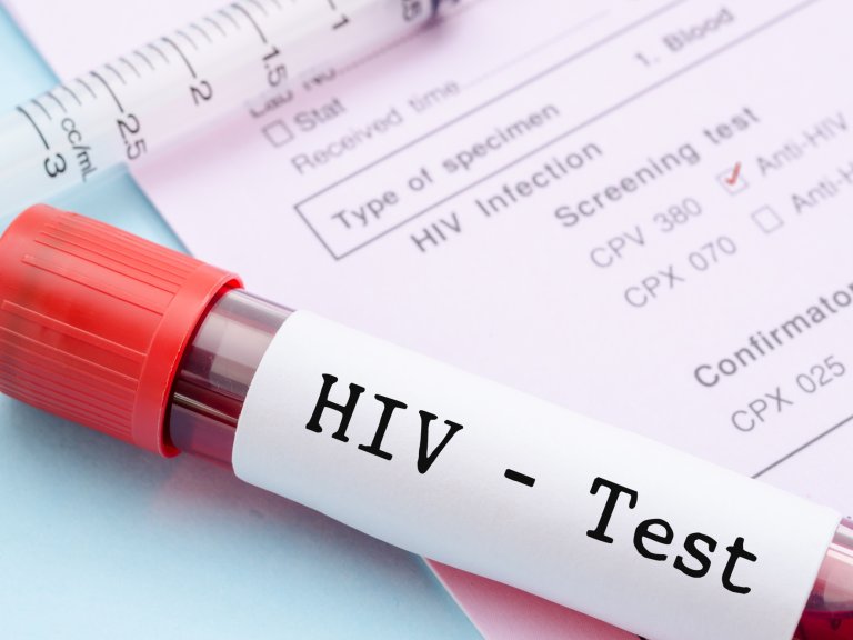 Discovery of new more infectious HIV variant