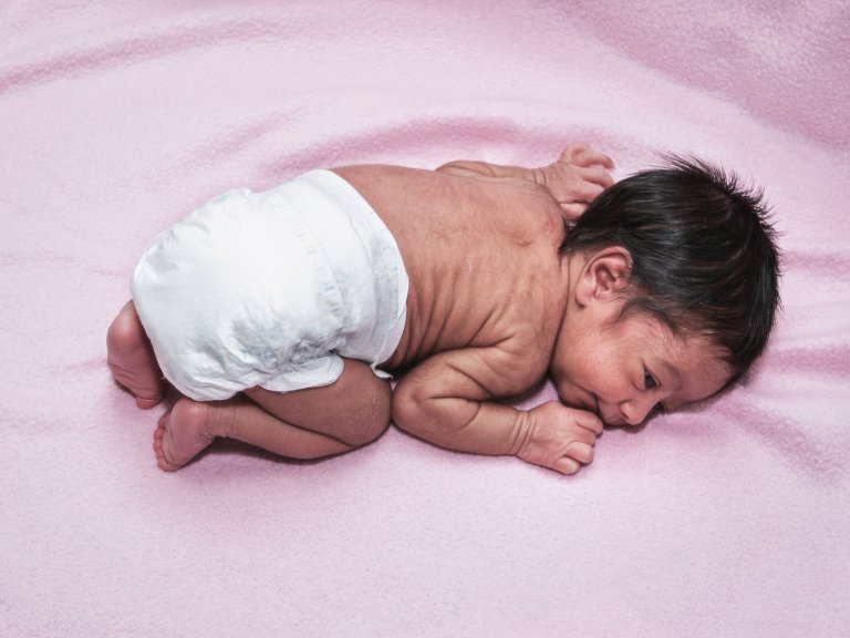 Hoe babyplasjes de kwaliteit van donornieren kunnen verbeteren