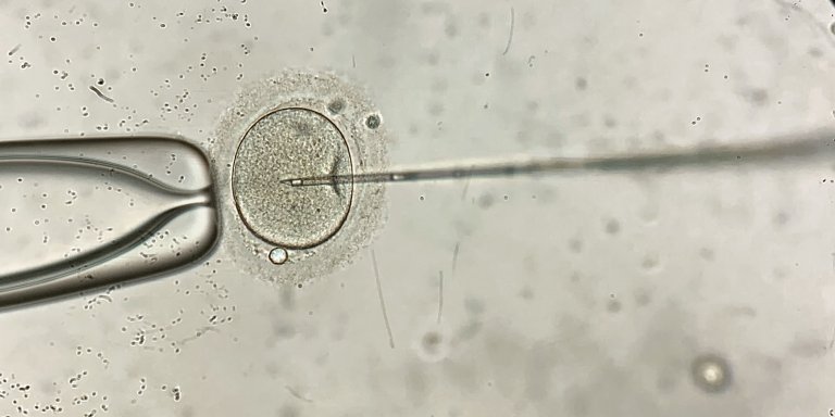 New IVF Method: more expensive, not more effective 