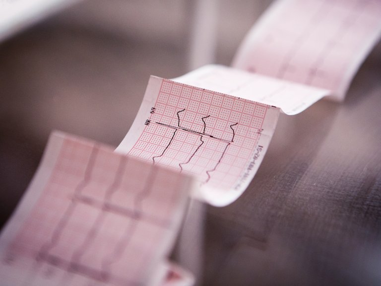 AI may help identify cardiac amyloidosis on routine ECGs