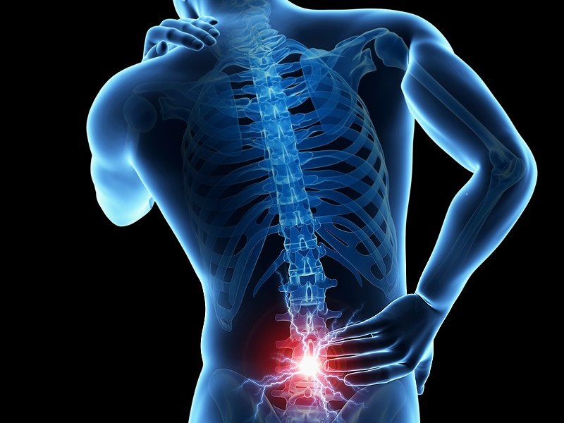 The riddles of low back pain