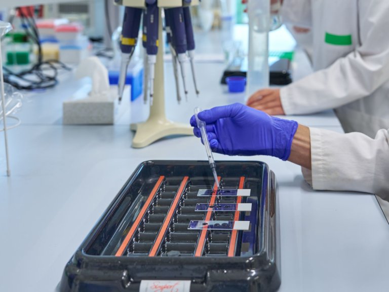 Head and neck cancer biology and immunology (HNCBI) research group